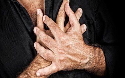 Costochondritis