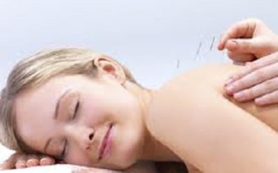 Acupuncture: Pre and Post Surgery