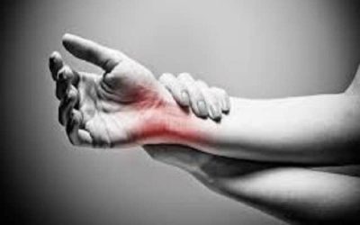 Carpal Tunnel Syndrome