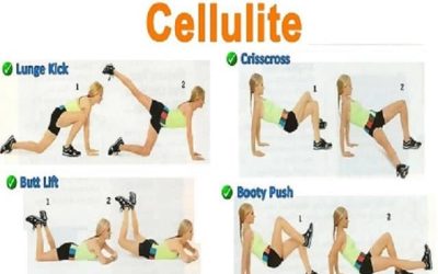 Combating Cellulite