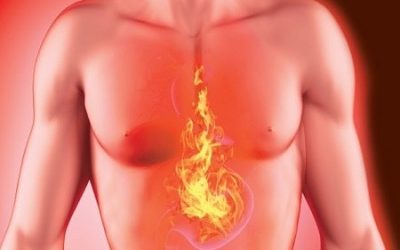 Top 20 Tips for Heartburn