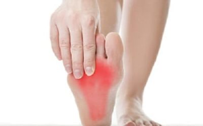 Exercises for Plantar Fasciitis