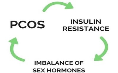 PCOS – Polycystic Ovarian Syndrome