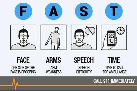 Recognize the Signs of Stroke